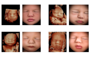 Descubre el Rostro de tu Bebé con Aplicaciones