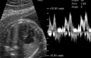 Aplicaciones para Escuchar el Corazón del Bebé